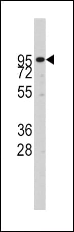 ADAM17 / TACE Antibody (aa195-224)