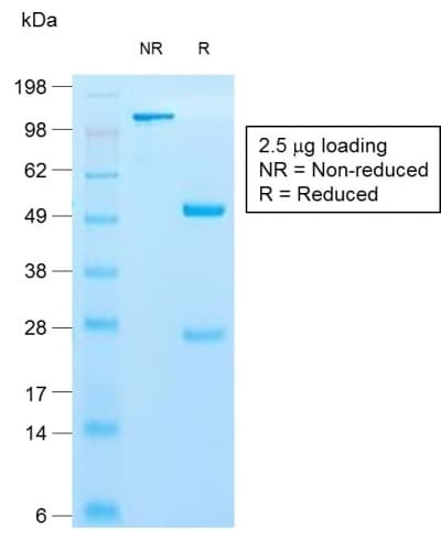 PathPlus™ KRT10 / CK10 / Cytokeratin 10 Antibody (clone KRT10/1990R)