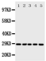 SFN / Stratifin / 14-3-3 Sigma Antibody (aa140-156)
