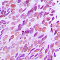 XRCC2 Antibody (C-Terminus)