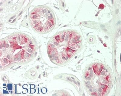 IHC-plus™ Polyclonal Rabbit anti-Human GRB4 / NCK2 Antibody (IHC, WB)