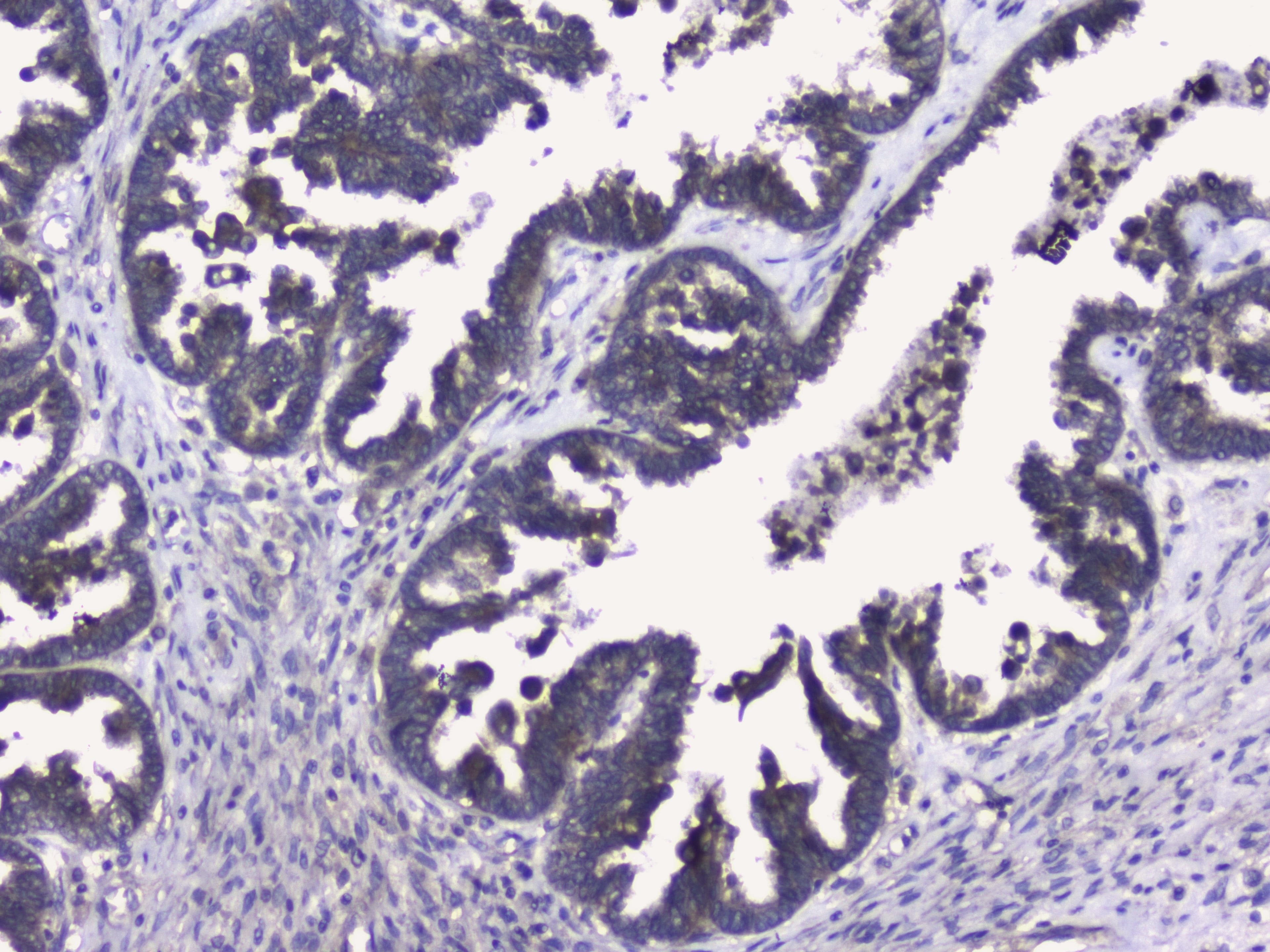 Polyclonal Rabbit anti-Human RIP1 / RALBP1 Antibody (IHC, WB)