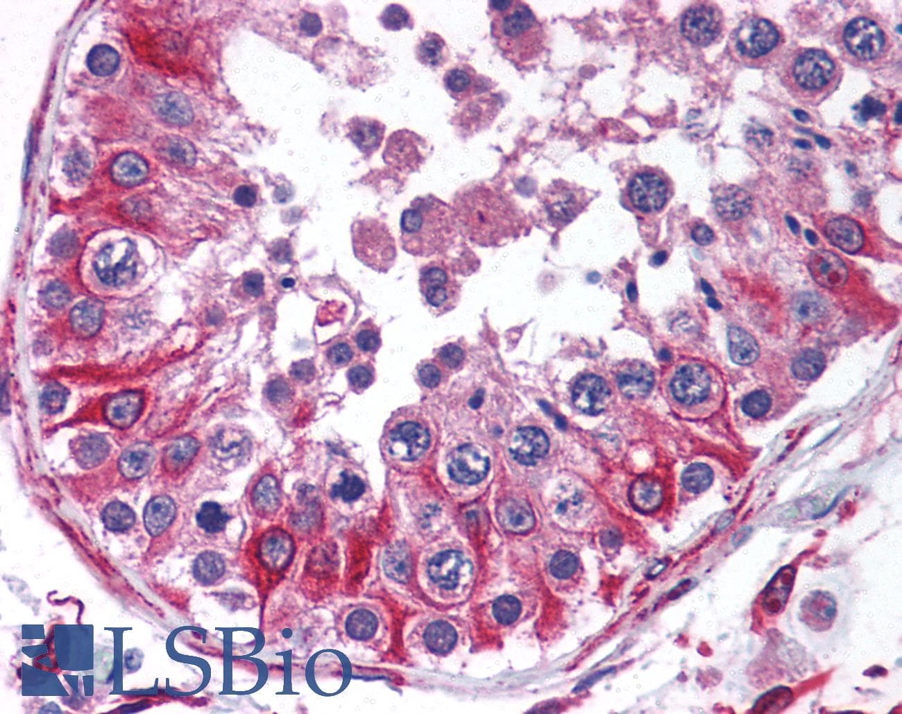IHC-plus™ PTRH2 / BIT1 Antibody
