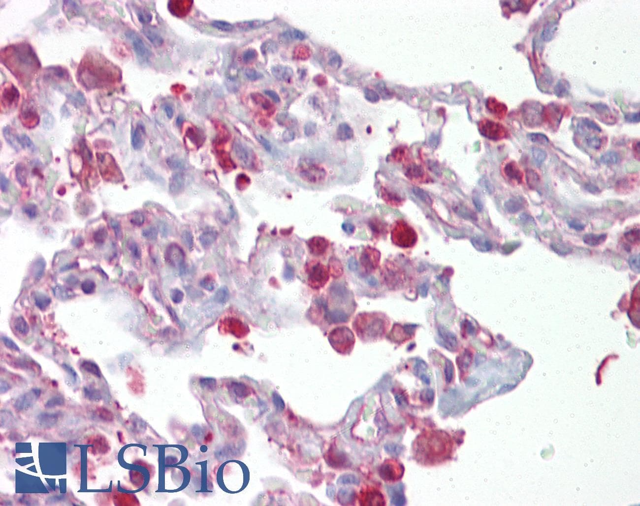 Polyclonal Rabbit anti-Human FRA-1 / FOSL1 Antibody (aa143-192, IHC, WB)