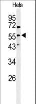 Vimentin Antibody (Ser82)