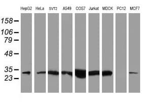 NQO2 Antibody (clone OTI3G4)