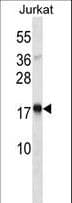 TSLP Antibody (aa101-130)