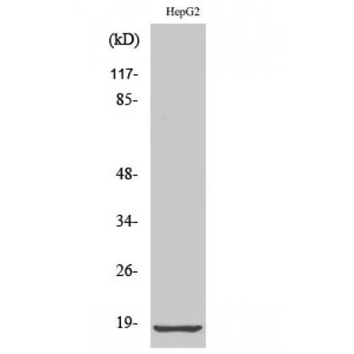 Polyclonal Rabbit anti-Human RPL12 / Ribosomal Protein L12 Antibody (30-110 aa, Internal, IHC, WB)