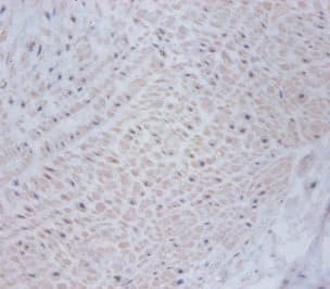 CSRP1 Antibody