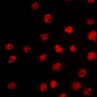TBX15+18 Antibody (Internal)