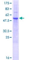 Human NKG2DL4 / ULBP4 Protein (Recombinant GST)