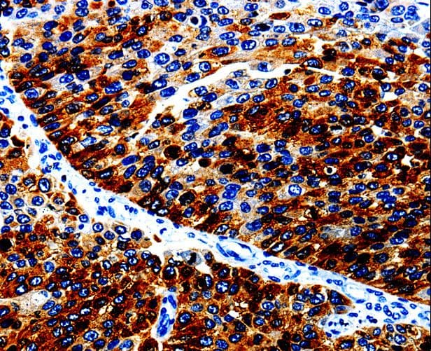 AGR2 Antibody