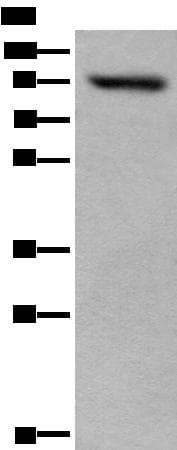 Polyclonal Rabbit anti-Human USP6NL Antibody (IHC, WB)