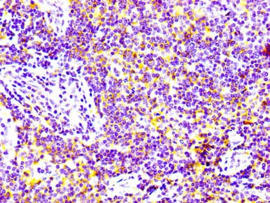 Recombinant Monoclonal Rabbit anti-Human ADGRE5 / CD97 Antibody (IHC, IF)