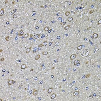 Polyclonal Rabbit anti-Human PTCD3 Antibody (IHC, WB)