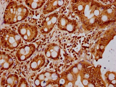 Polyclonal Rabbit anti-Human HIST1H3A Antibody (IHC)