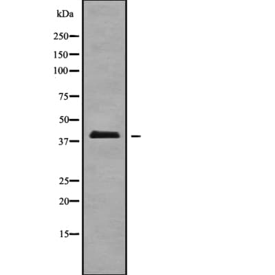 A4GALT Antibody