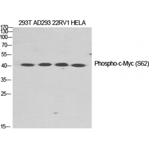 MYC / c-Myc Antibody (1-80 aa)