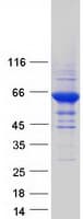 Human RPE65 Protein (Recombinant Myc-DDK (Flag))