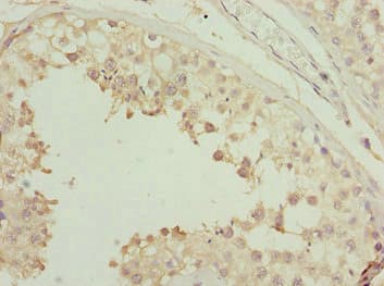 SYCE1 Antibody