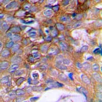 HIBADH Antibody (C-Terminus)