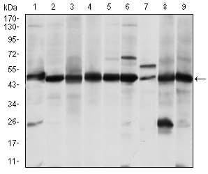 IHC-plus™ ASS1 / ASS Antibody (clone 2B10)