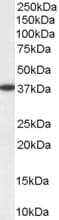 IHC-plus™ Polyclonal Goat anti-Human AKR1A1 Antibody (aa313-325, IHC, WB)
