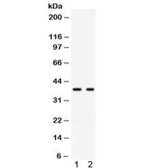 GAL4 / Galectin 4 Antibody