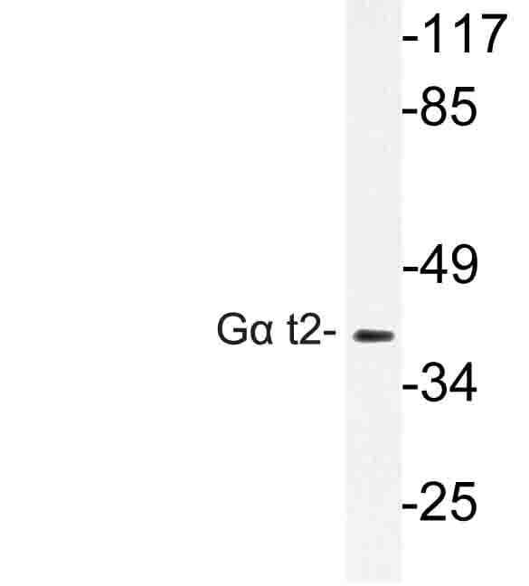 GNAT2 Antibody (Val34)