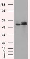ATP5B / ATP Synthase Beta Antibody (clone OTI6C4)