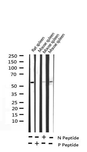 p56lck / LCK Antibody (phospho-Tyr393)