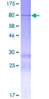Human LNPK / KIAA1715 Protein (Recombinant GST)
