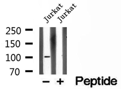 OTUD7B / Cezanne Antibody