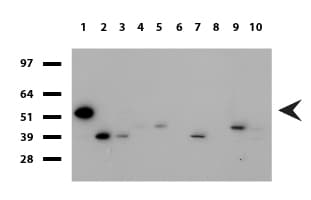 Monoclonal Mouse anti-Human PDCD1 / CD279 / PD-1 Antibody (clone UMAB198, Carrier-free, IHC, IF, WB)