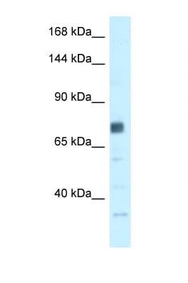 BRCA1 Antibody (N-Terminus)
