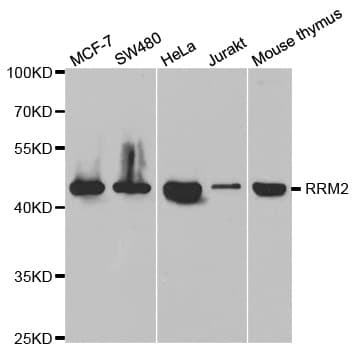 Polyclonal Rabbit anti-Human RRM2 Antibody (IHC, IF, WB)