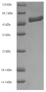 Bradyrhizobium Formamidase (amiF) Protein (Recombinant 6His-SUMO, N-terminus)