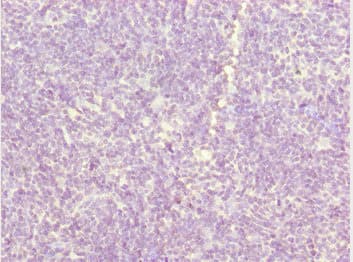 Polyclonal Rabbit anti-Human ZDHHC16 Antibody (IHC, WB)