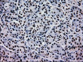 MAPK1 / ERK2 Antibody (clone OTI9H1)