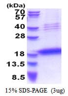 Human LECT1 / Chondromodulin-I Protein (Recombinant His)