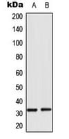 RPS6 / Ribosomal Protein S6 Antibody (phospho-Ser235)