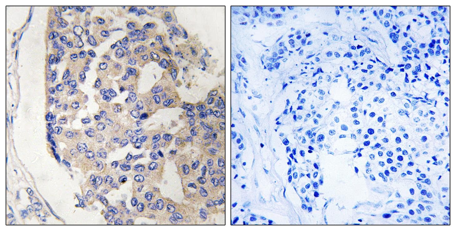 Polyclonal Rabbit anti-Human Complement C1s Antibody (IHC, WB)