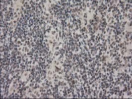 PRKCE / PKC-Epsilon Antibody (clone OTI4G8)