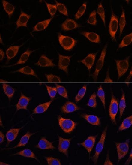 CTNNA3 / Alpha-3 Catenin Antibody