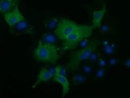 KLHL2 / MAV Antibody (aa1-100, clone OTI1G7, Carrier-free)