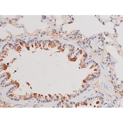 ADD1 / Adducin Alpha Antibody (phospho-Ser726)