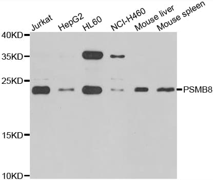 IHC-plus™ Polyclonal Rabbit anti-Human PSMB8 / LMP7 Antibody (IHC, IF, WB)