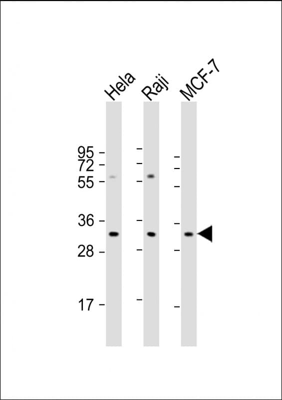 APIP Antibody (Internal)