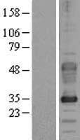 FXYD5 / Dysadherin Protein (Over-Expression Lysate Myc-DDK (Flag))