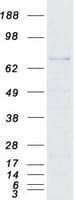 Human SPIRE2 Protein (Recombinant Myc-DDK (Flag))